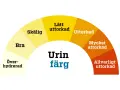 Färgkarta för urin. Mörkare färger indikerar uttorkning, vilket kan leda till illaluktande urin. Allvarligt uttorkad urin kan vara ett tecken på problem, men inte nödvändigtvis illaluktande urin cancer.