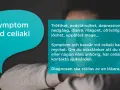 Trötthet, nedstämdhet, magont och uppblåst mage kan vara tecken på tyst celiaki. Kontakta sjukvården om du misstänker det.