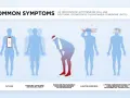 Illustration av vanliga symtom vid POTS: svullna ben, trötthet, svimning, intolerans mot träning, yrsel, hjärndimma och snabb puls.