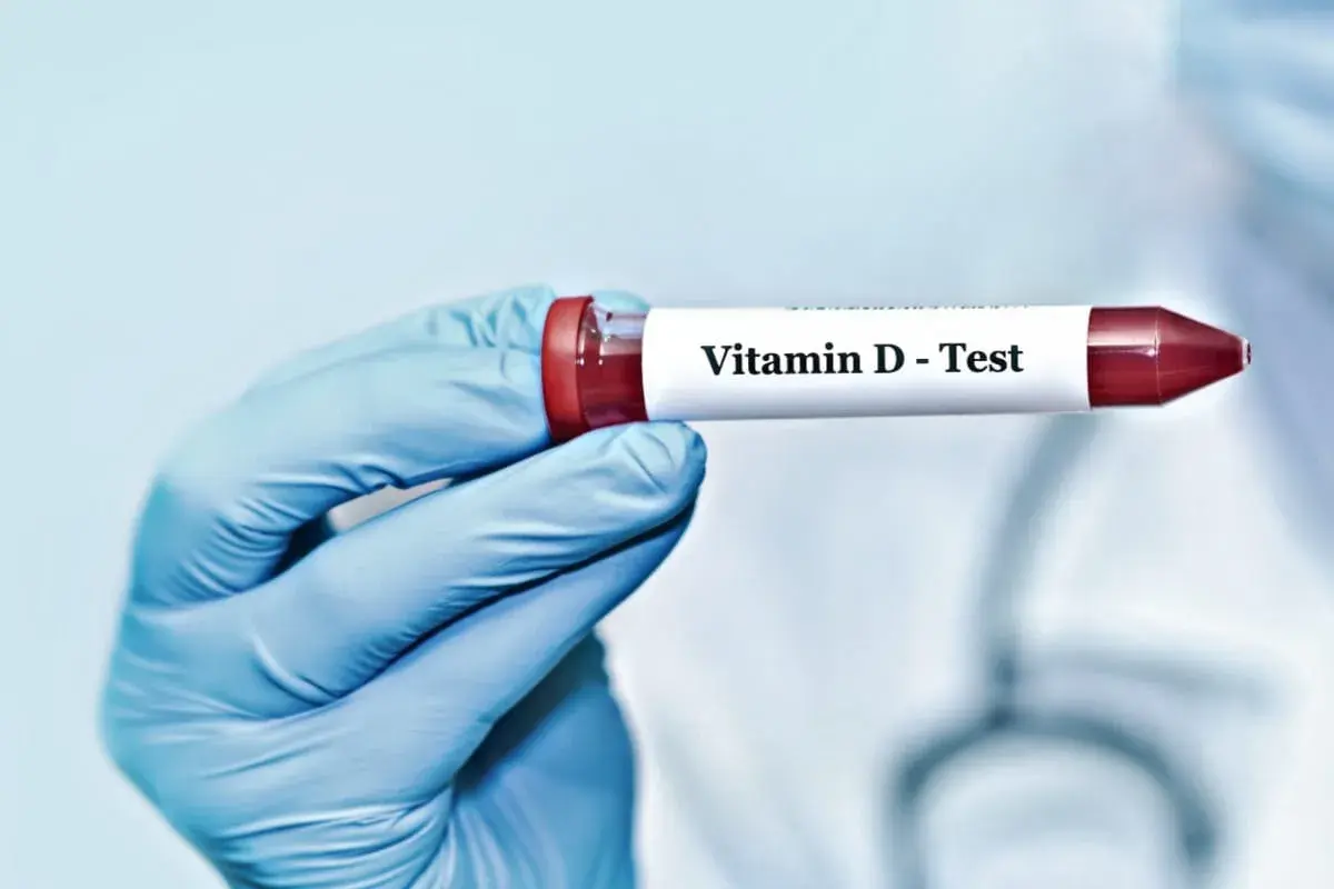 Blåklädd hand håller provrör märkt "Vitamin D - Test". Kan indikera d-vitamin brist symtom.
