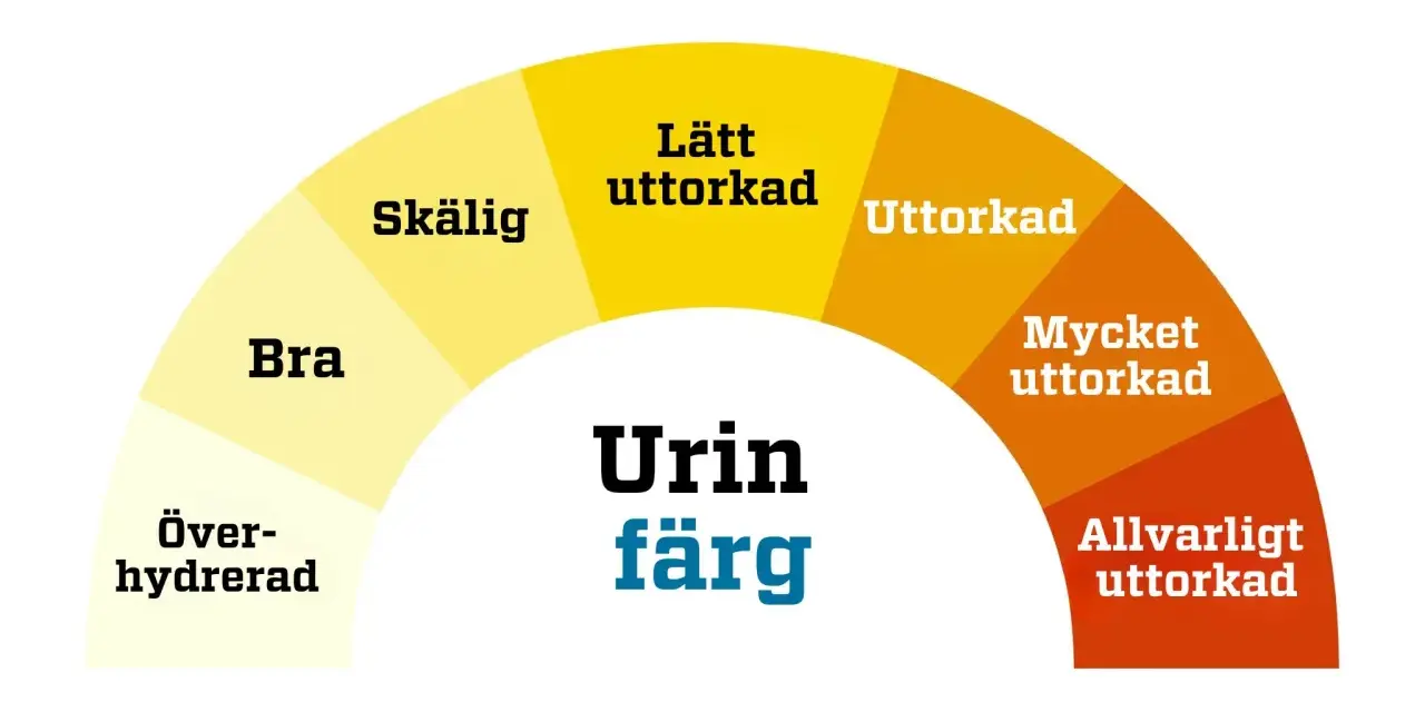 Färgkarta för urin. Mörkare färger indikerar uttorkning, vilket kan leda till illaluktande urin. Allvarligt uttorkad urin kan vara ett tecken på problem, men inte nödvändigtvis illaluktande urin cancer.