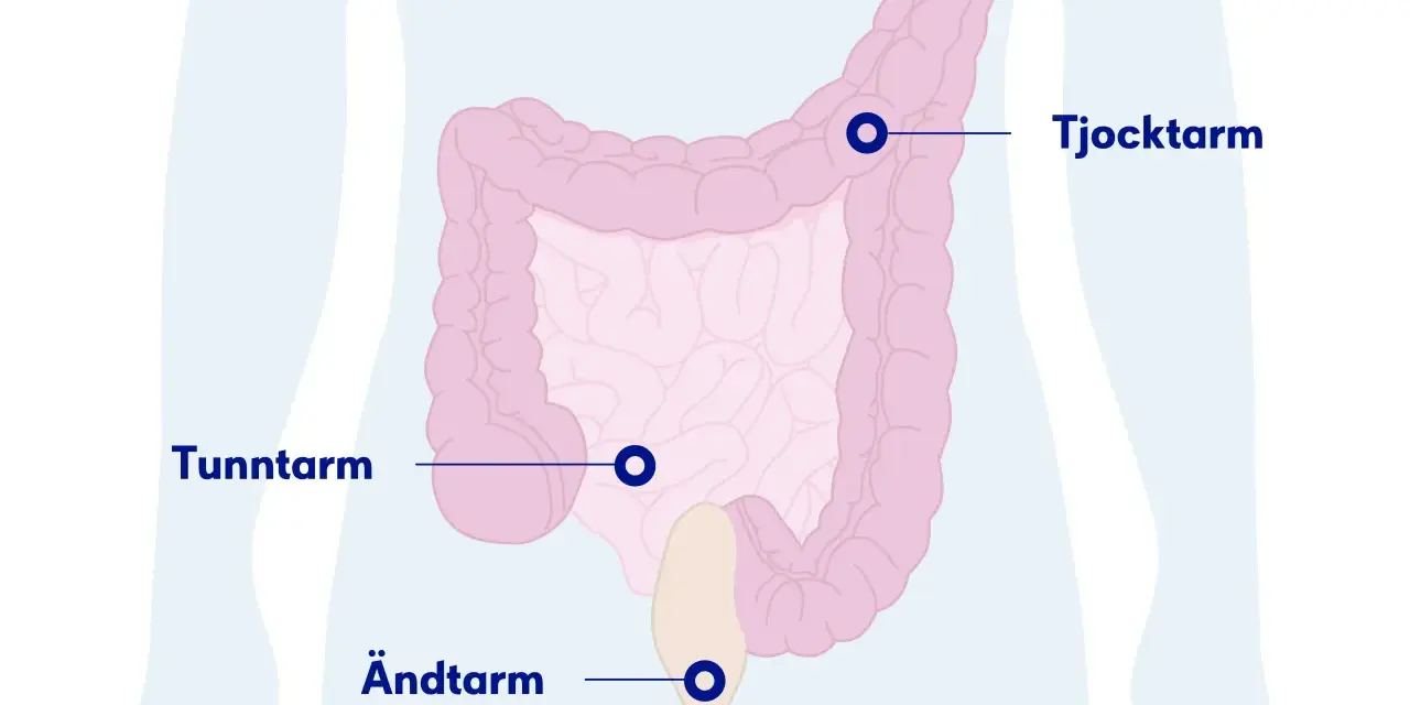Illustration av tunntarm, tjocktarm och ändtarm. Om du har ont i magen kan det bero på problem i dessa delar.