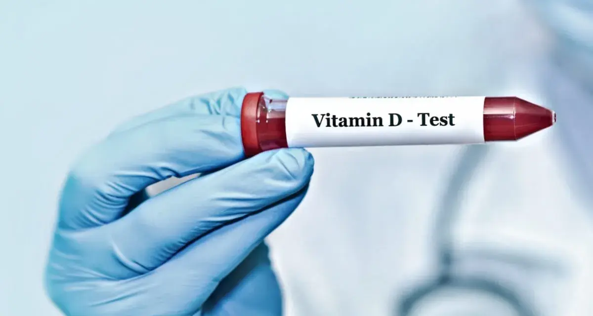 Blåklädd hand håller provrör märkt "Vitamin D - Test". Kan indikera d-vitamin brist symtom.