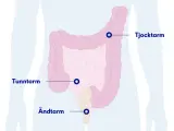 Illustration av tunntarm, tjocktarm och ändtarm. Om du har ont i magen kan det bero på problem i dessa delar.