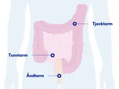 Illustration av tunntarm, tjocktarm och ändtarm. Om du har ont i magen kan det bero på problem i dessa delar.