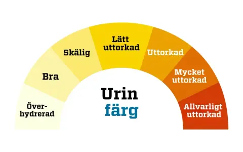 Färgkarta för urin. Mörkare färger indikerar uttorkning, vilket kan leda till illaluktande urin. Allvarligt uttorkad urin kan vara ett tecken på problem, men inte nödvändigtvis illaluktande urin cancer.