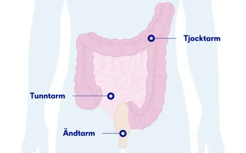 Illustration av tunntarm, tjocktarm och ändtarm. Om du har ont i magen kan det bero på problem i dessa delar.