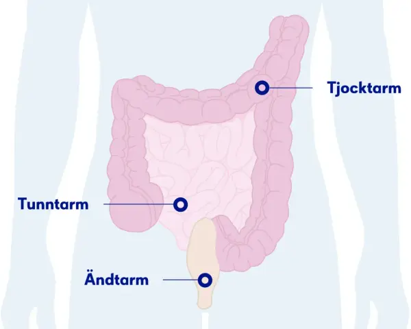 Illustration av tunntarm, tjocktarm och ändtarm. Om du har ont i magen kan det bero på problem i dessa delar.