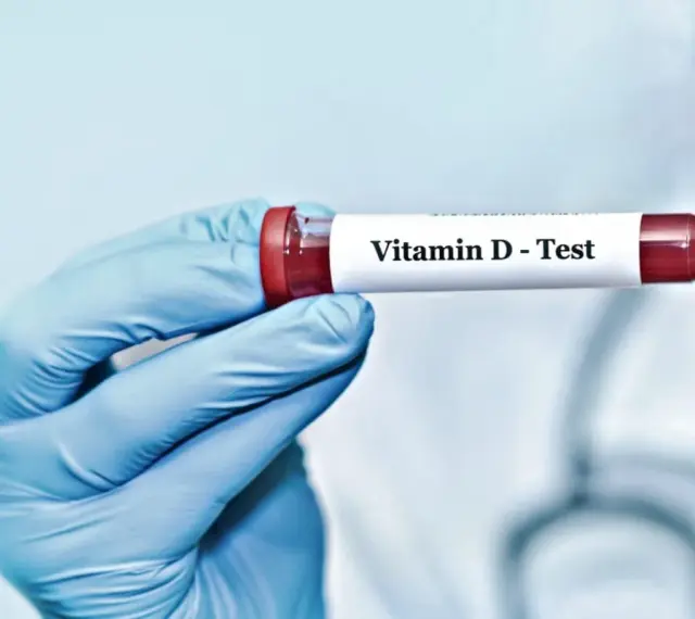 Blåklädd hand håller provrör märkt "Vitamin D - Test". Kan indikera d-vitamin brist symtom.