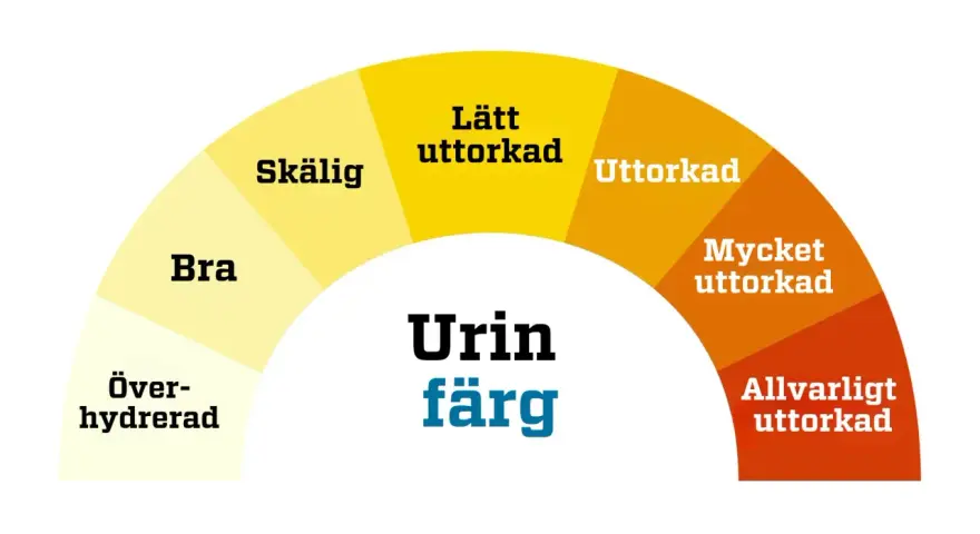 Färgkarta för urin. Mörkare färger indikerar uttorkning, vilket kan leda till illaluktande urin. Allvarligt uttorkad urin kan vara ett tecken på problem, men inte nödvändigtvis illaluktande urin cancer.