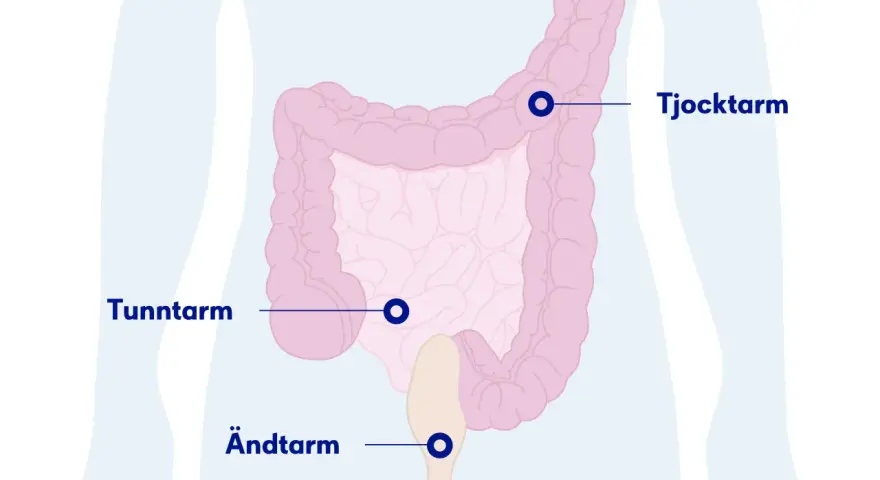 Illustration av tunntarm, tjocktarm och ändtarm. Om du har ont i magen kan det bero på problem i dessa delar.