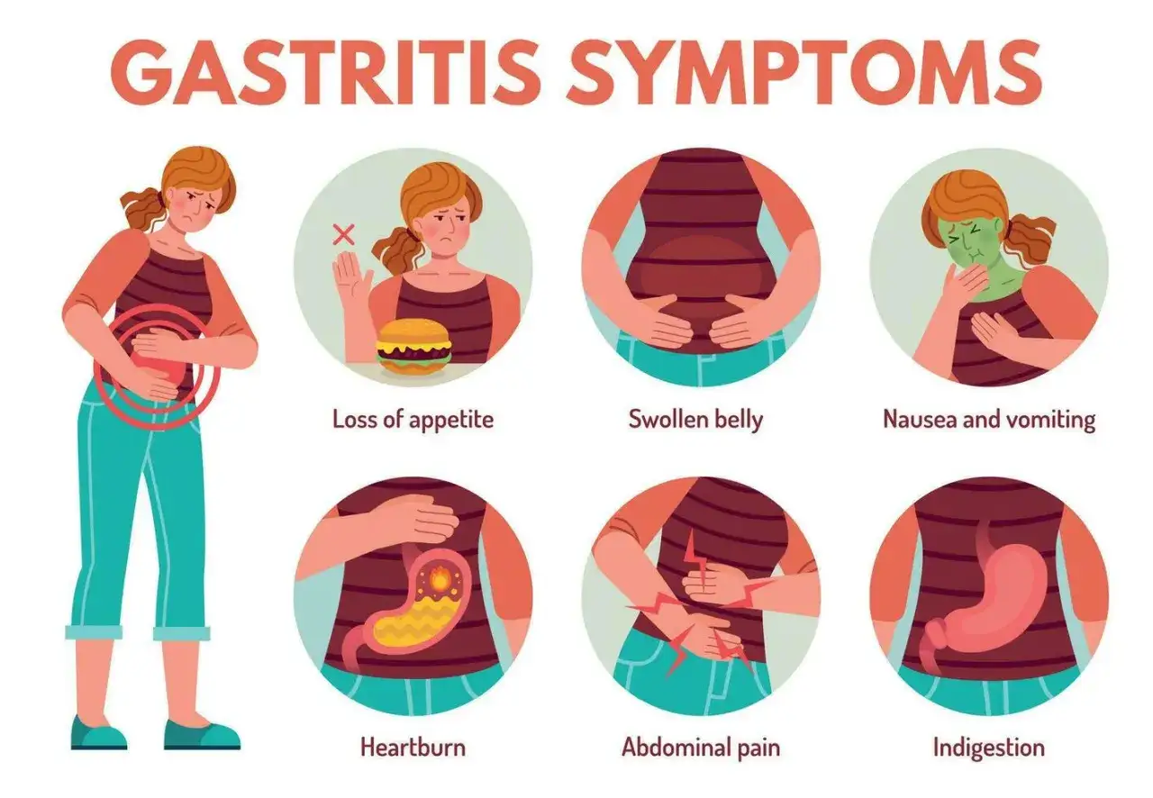 Illustration visar symtom på gastrit: illamående, uppsvälld mage, halsbränna, magsmärta och dålig aptit. Ont i magen är ett vanligt tecken.