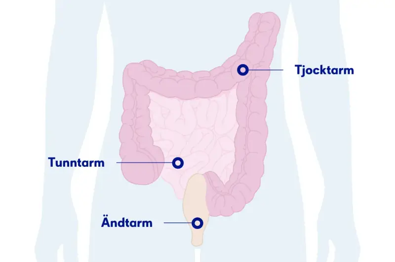 Illustration av tunntarm, tjocktarm och ändtarm. Om du har ont i magen kan det bero på problem i dessa delar.